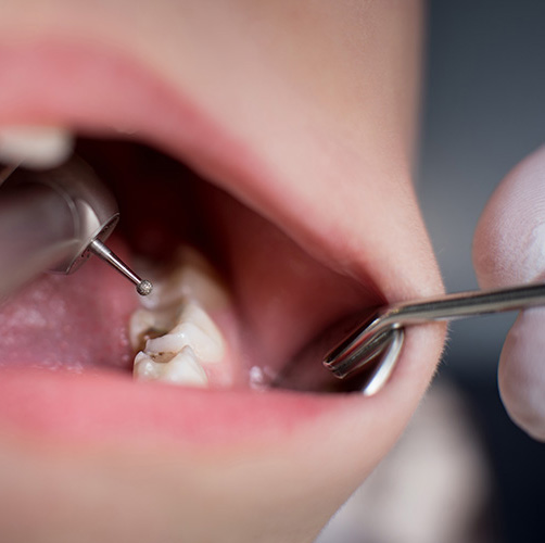 Odontología conservadora