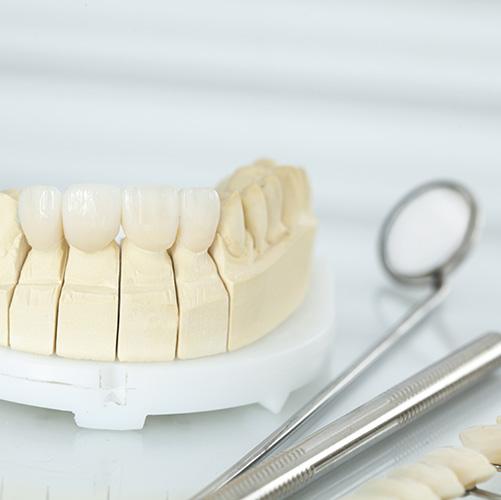 Estética dental