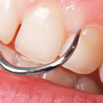 Periodoncia
